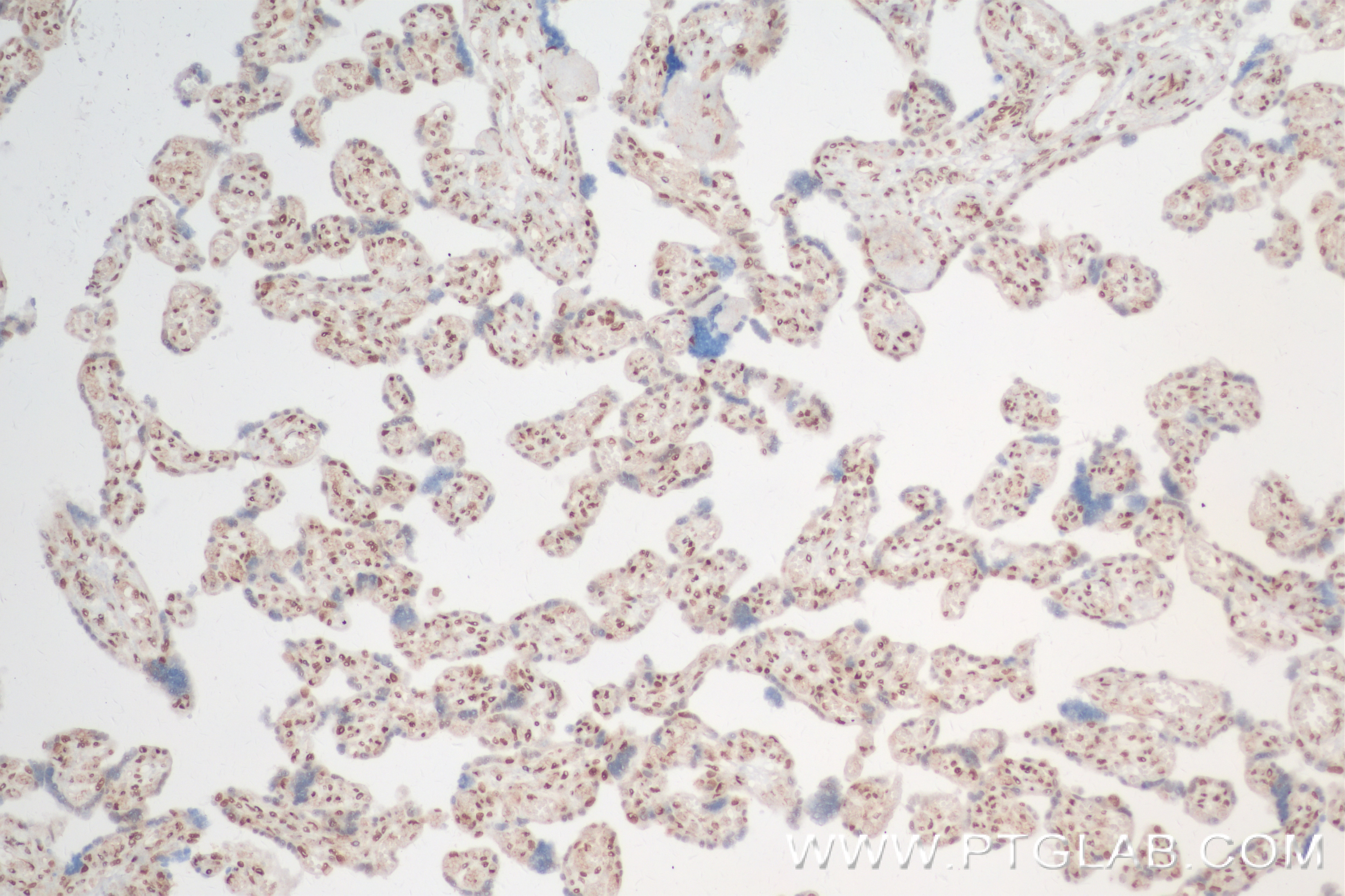 Immunohistochemistry (IHC) staining of human placenta tissue using FOXK2 Recombinant antibody (83735-4-RR)