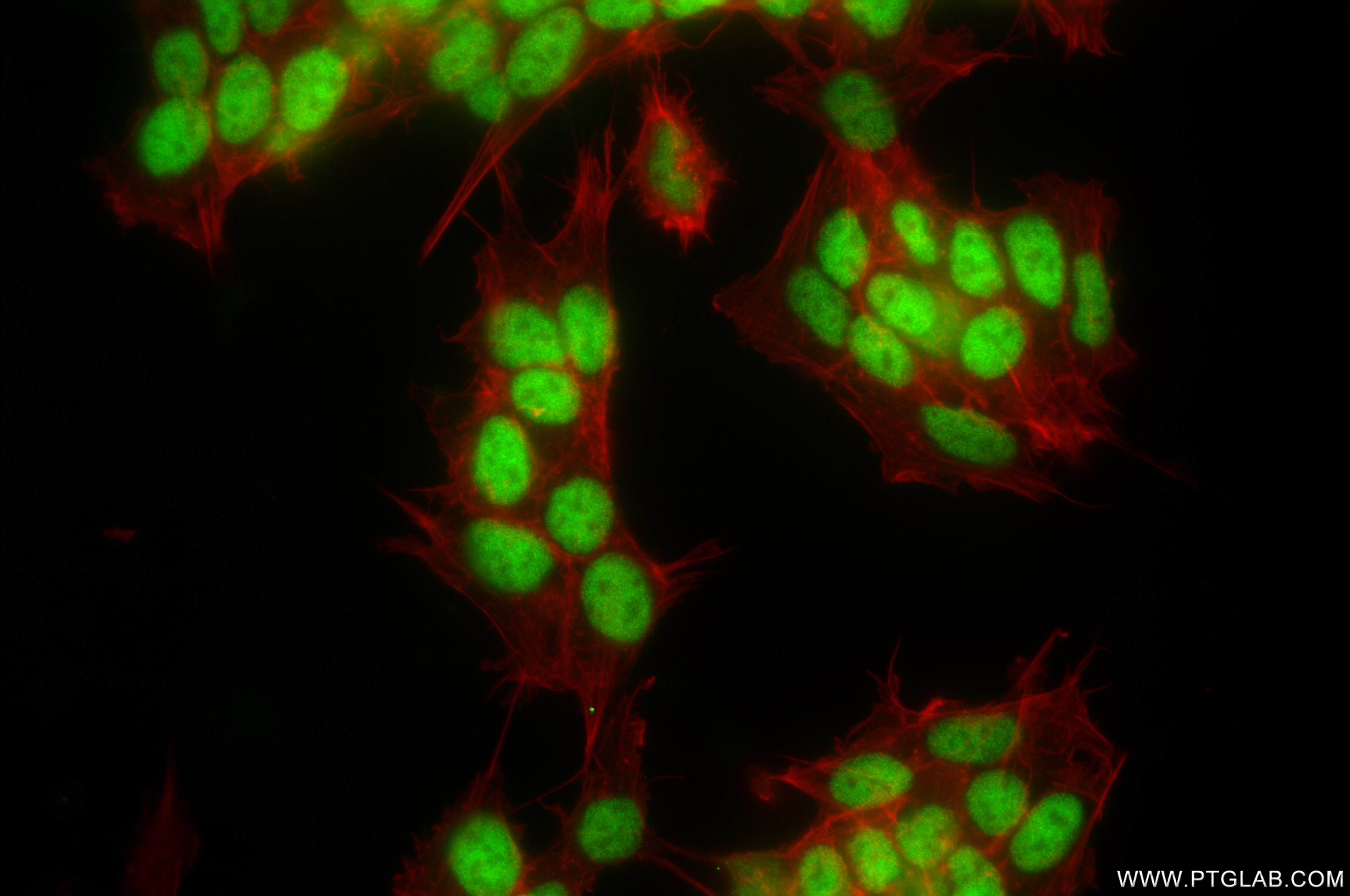 Immunofluorescence (IF) / fluorescent staining of SH-SY5Y cells using FOXK2 Recombinant antibody (83735-6-RR)