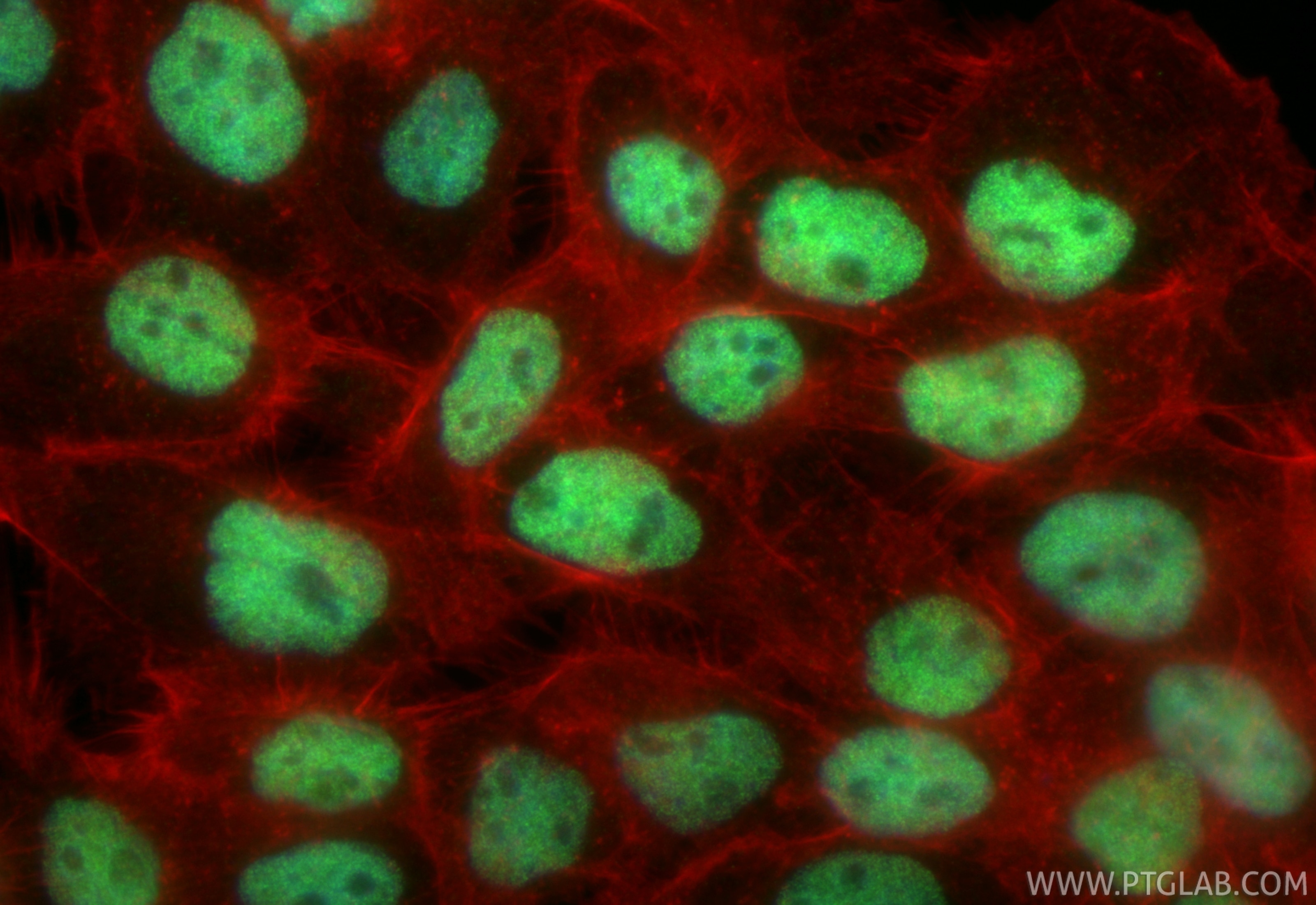 Immunofluorescence (IF) / fluorescent staining of A431 cells using FOXK2 Recombinant antibody (83735-6-RR)
