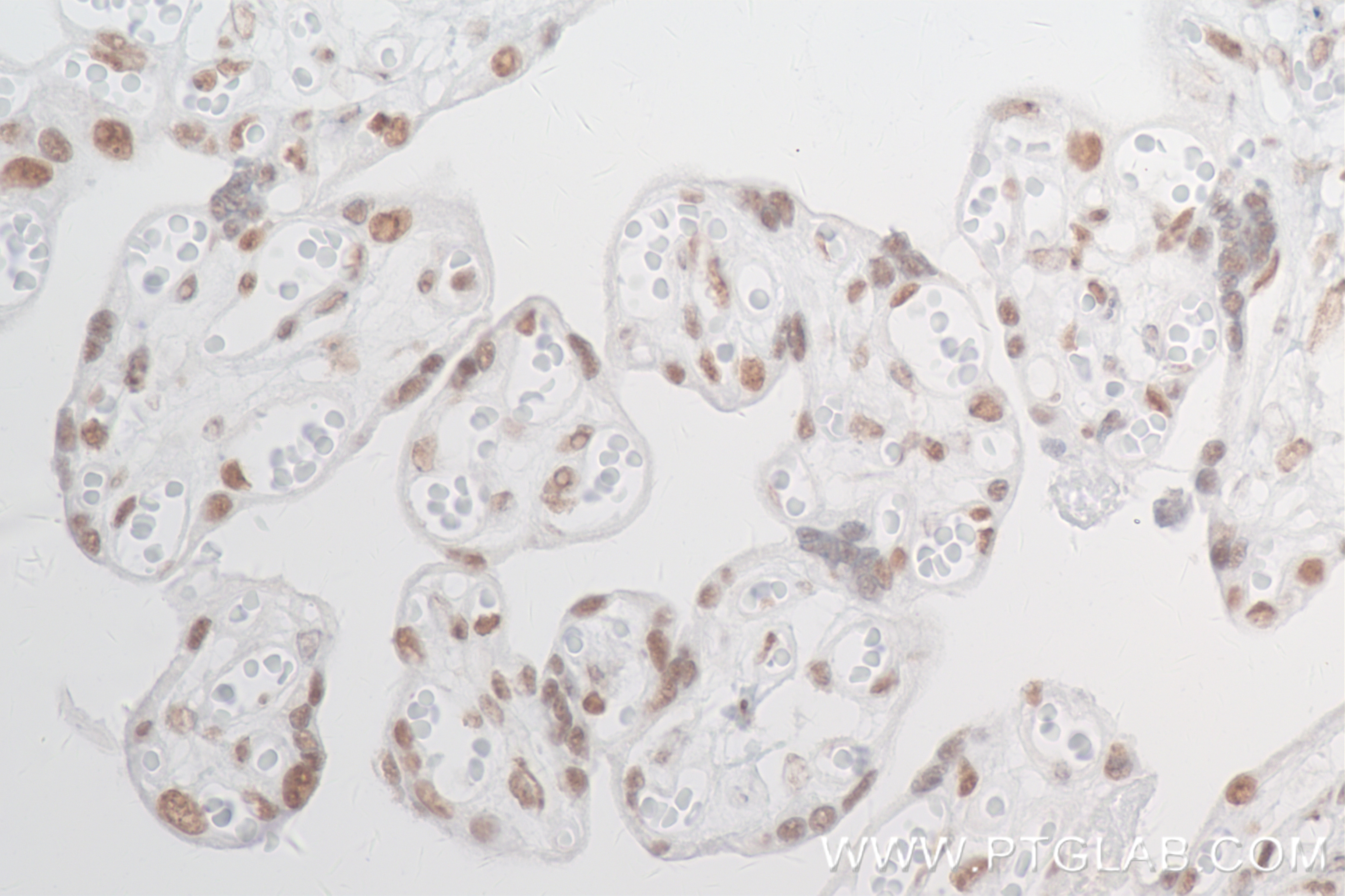 Immunohistochemistry (IHC) staining of human placenta tissue using FOXK2 Recombinant antibody (83735-6-RR)