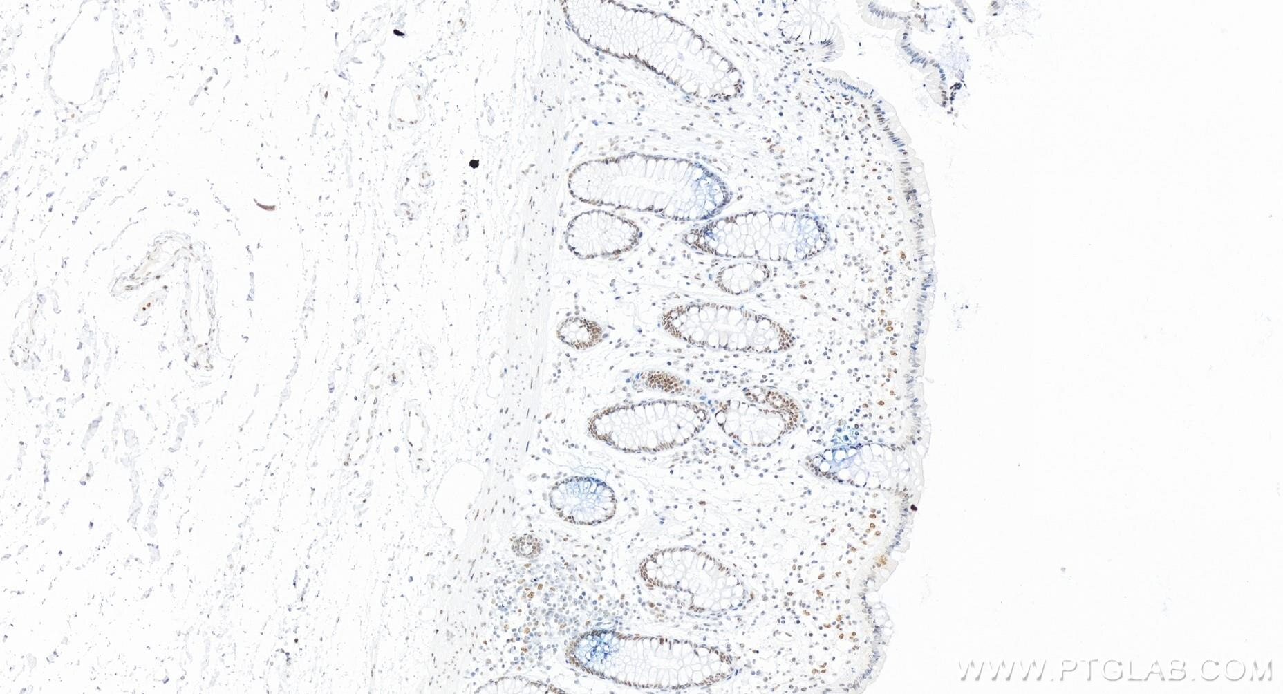 Immunohistochemistry (IHC) staining of human colon tissue using FOXK2 Recombinant antibody (83735-6-RR)