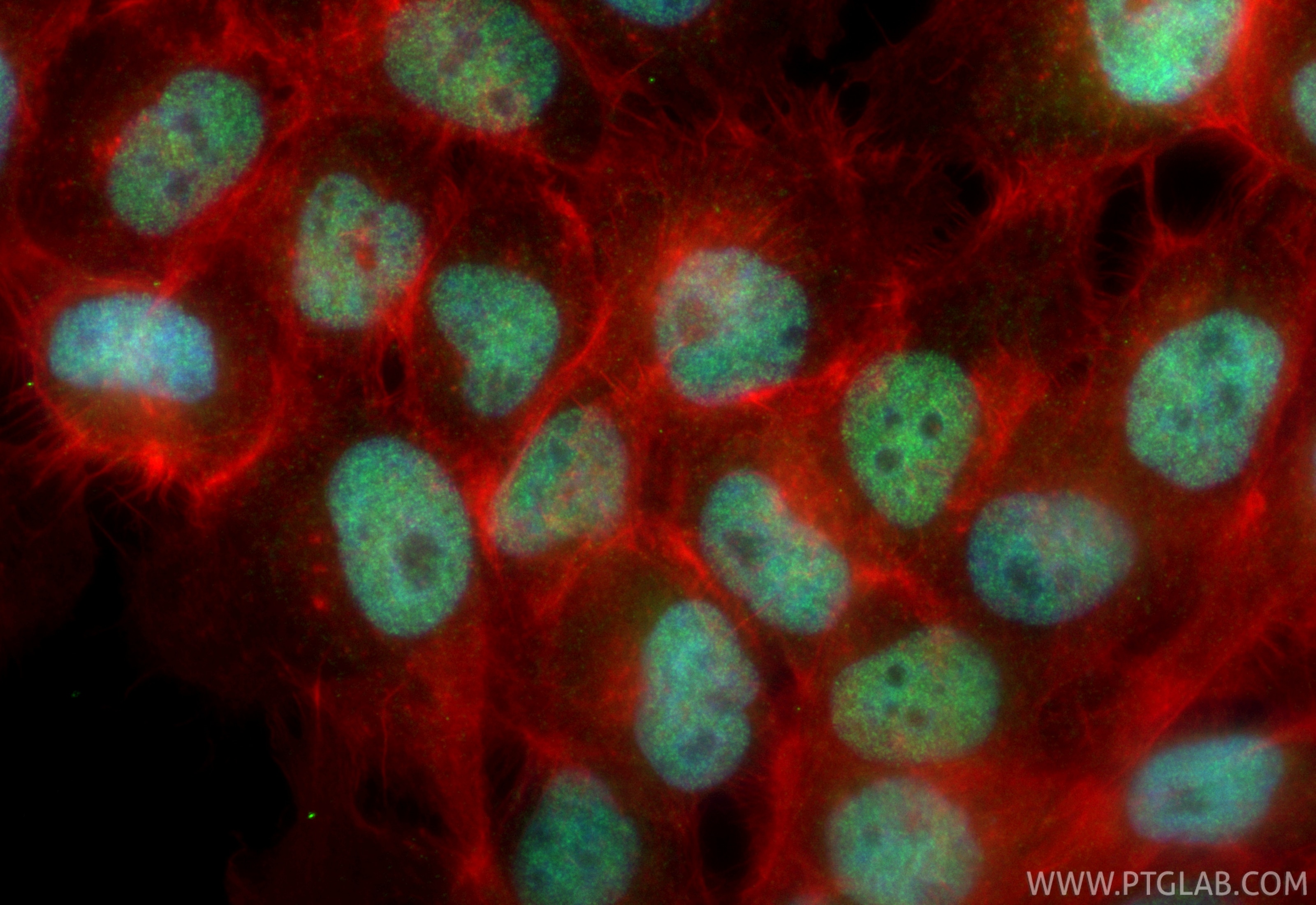 Immunofluorescence (IF) / fluorescent staining of A431 cells using CoraLite® Plus 488-conjugated FOXK2 Recombinant an (CL488-83735-6)