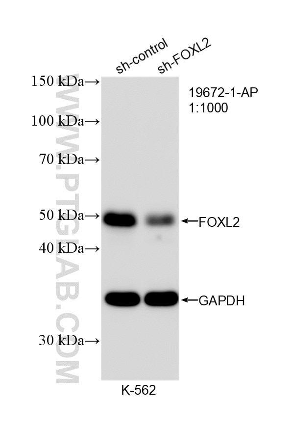 WB analysis of K-562 using 19672-1-AP Western Blot (WB) analysis of K-562 cells using FOXL2-Specific Polyclonal antibody (19672-1-AP)