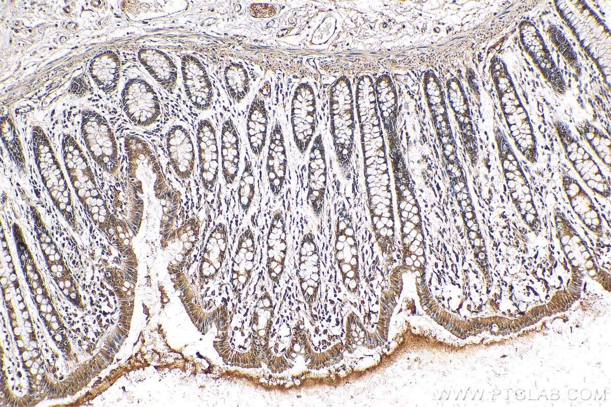 IHC staining of human colon using 13147-1-AP