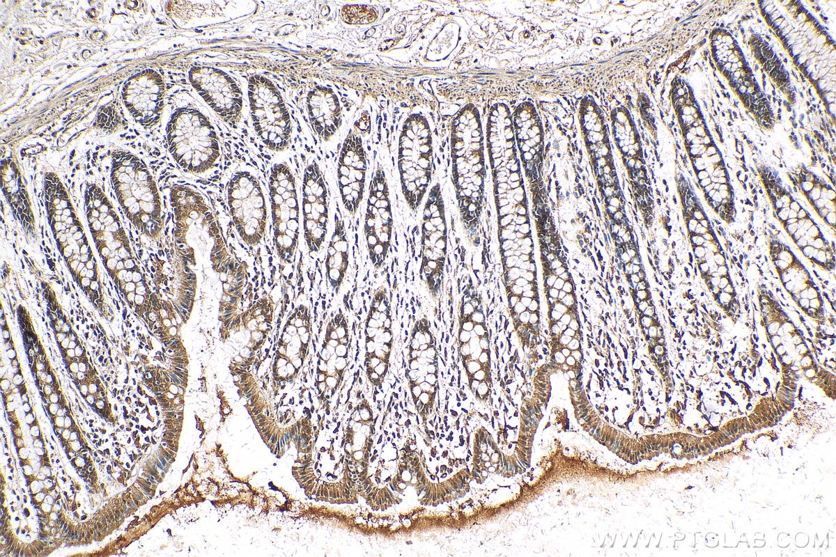 Immunohistochemistry (IHC) staining of human colon tissue using FOXM1 Polyclonal antibody (13147-1-AP)