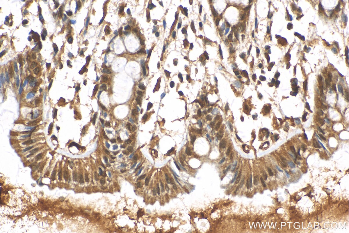 Immunohistochemistry (IHC) staining of human colon tissue using FOXM1 Polyclonal antibody (13147-1-AP)