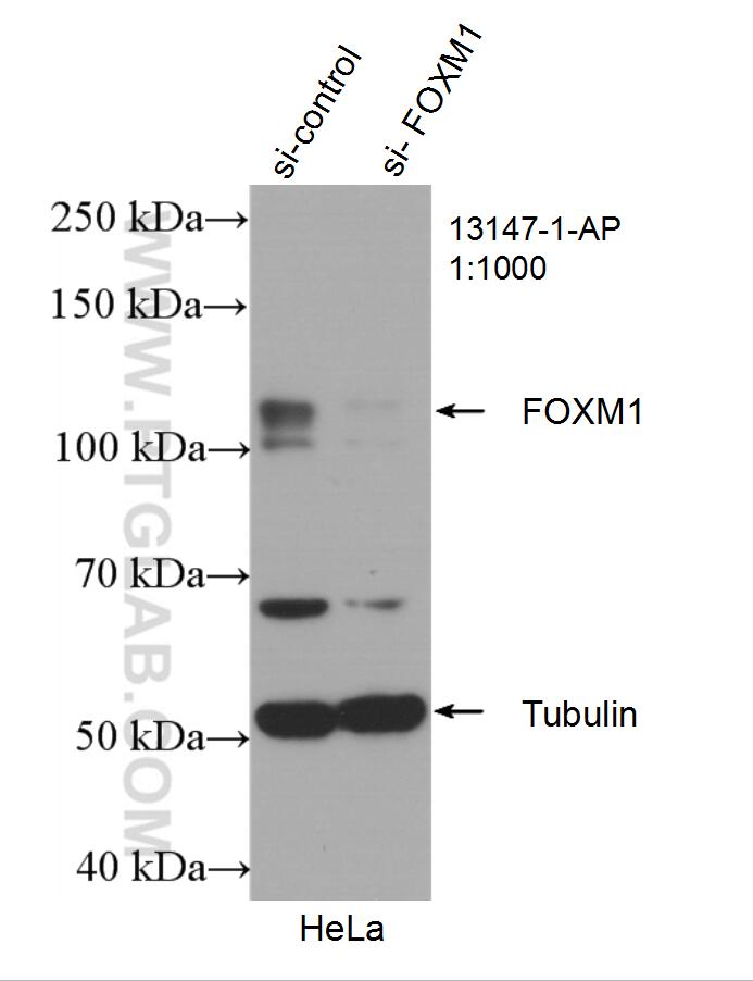 Western Blot (WB) analysis of HeLa cells using FOXM1 Polyclonal antibody (13147-1-AP)