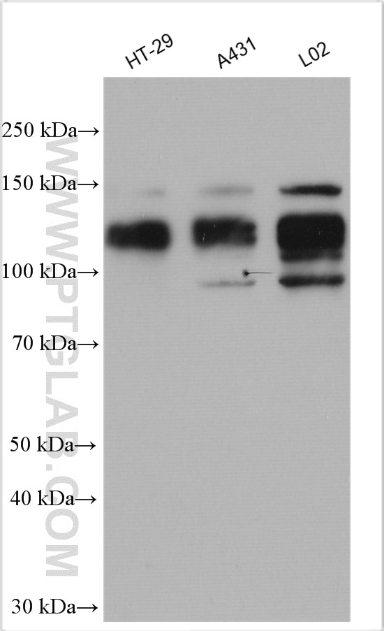 Western Blot (WB) analysis of various lysates using FOXM1 Polyclonal antibody (13147-1-AP)