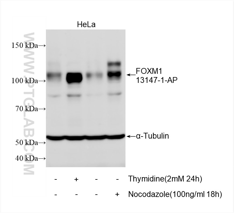 Western Blot (WB) analysis of HeLa cells using FOXM1 Polyclonal antibody (13147-1-AP)