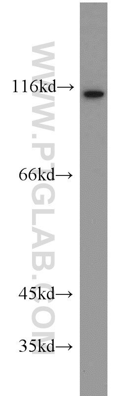 Western Blot (WB) analysis of mouse thymus tissue using FOXM1 Polyclonal antibody (13147-1-AP)