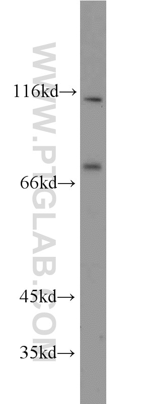 Western Blot (WB) analysis of mouse colon tissue using FOXM1 Polyclonal antibody (13147-1-AP)