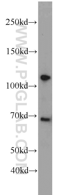 Western Blot (WB) analysis of mouse testis tissue using FOXM1 Polyclonal antibody (13147-1-AP)