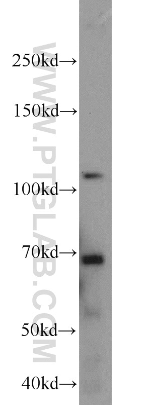 Western Blot (WB) analysis of mouse spleen tissue using FOXM1 Polyclonal antibody (13147-1-AP)