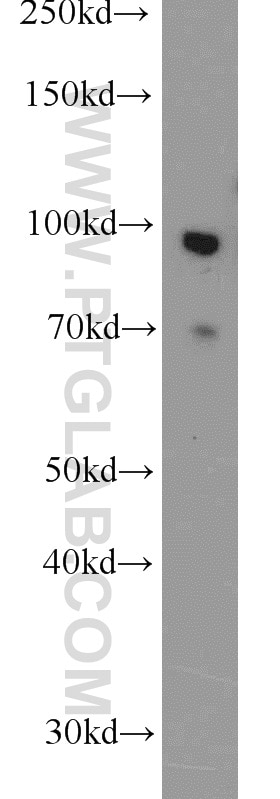 Western Blot (WB) analysis of human testis tissue using FOXM1 Polyclonal antibody (13147-1-AP)