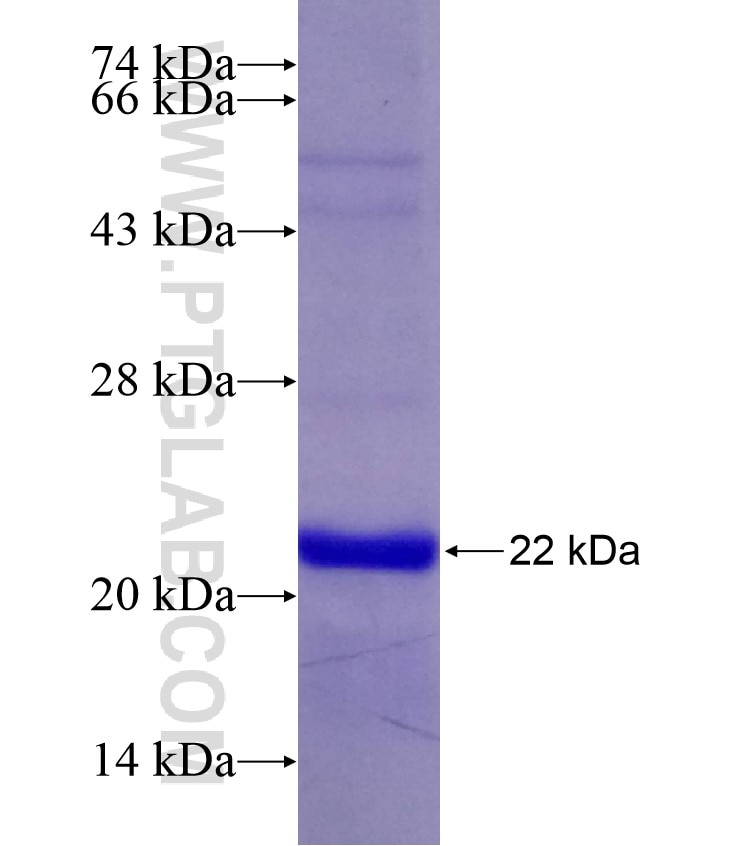 FOXM1 fusion protein Ag29275 SDS-PAGE