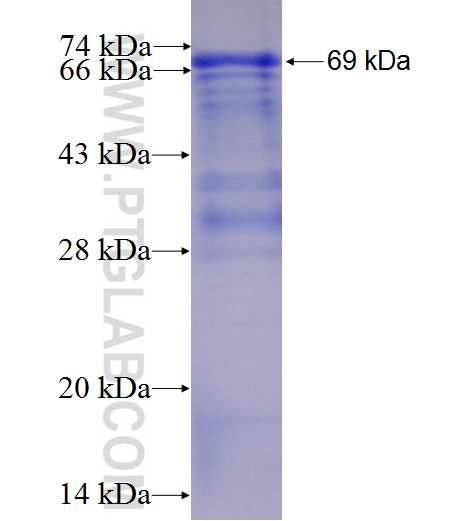 FOXM1 fusion protein Ag3729 SDS-PAGE