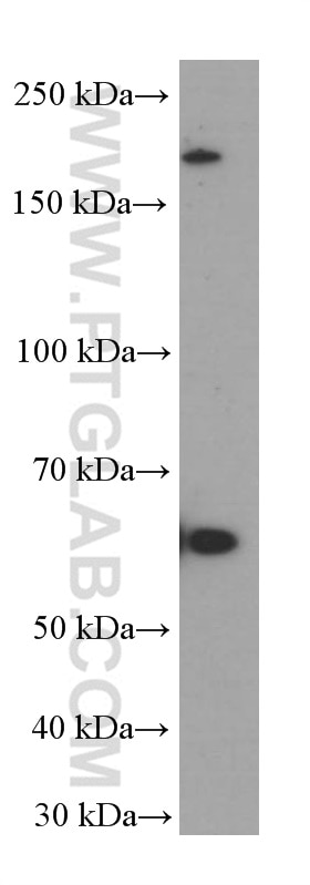 Western Blot (WB) analysis of Raji cells using FOXN1 Monoclonal antibody (66337-1-Ig)