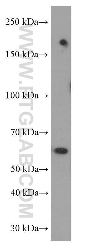 Western Blot (WB) analysis of Jurkat cells using FOXN1 Monoclonal antibody (66337-1-Ig)