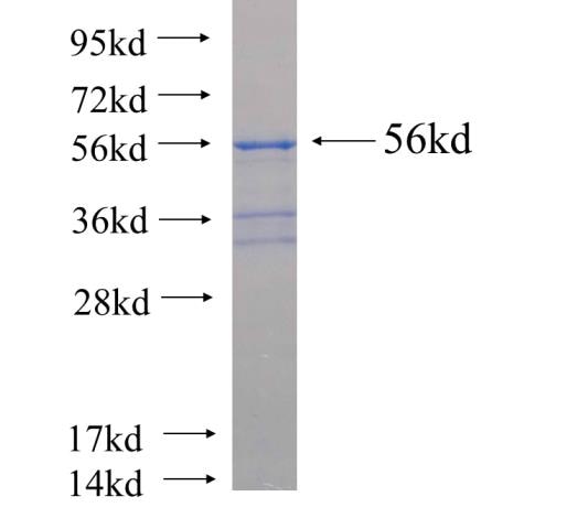 FOXN1 fusion protein Ag24810 SDS-PAGE
