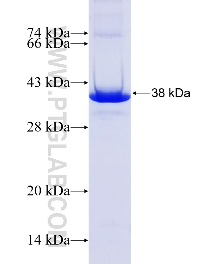 FOXN1 fusion protein Ag24823 SDS-PAGE
