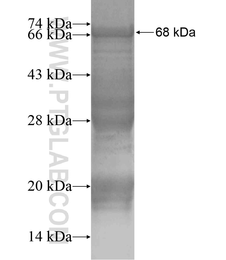 FOXN1 fusion protein Ag18207 SDS-PAGE