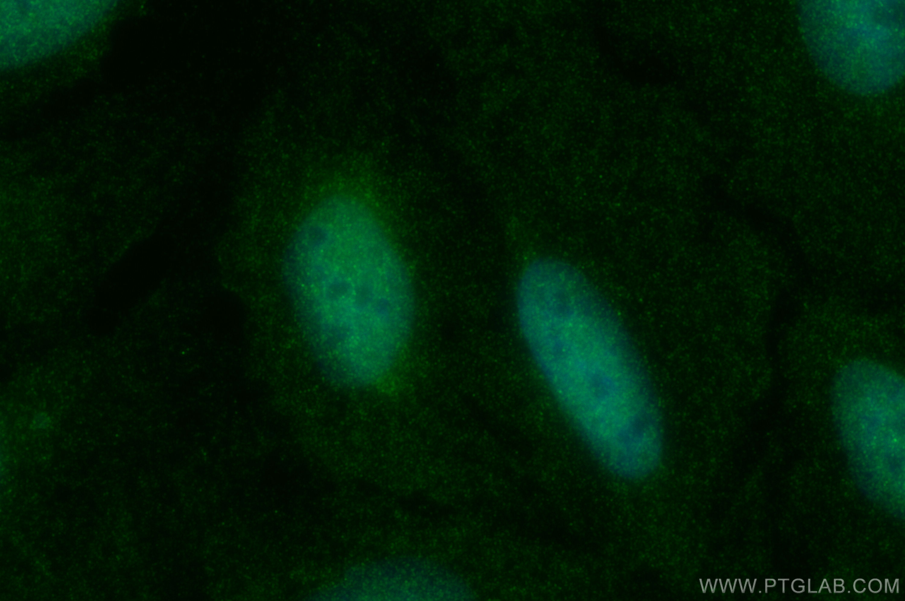 Immunofluorescence (IF) / fluorescent staining of U2OS cells using FOXN3 Polyclonal antibody (25399-1-AP)