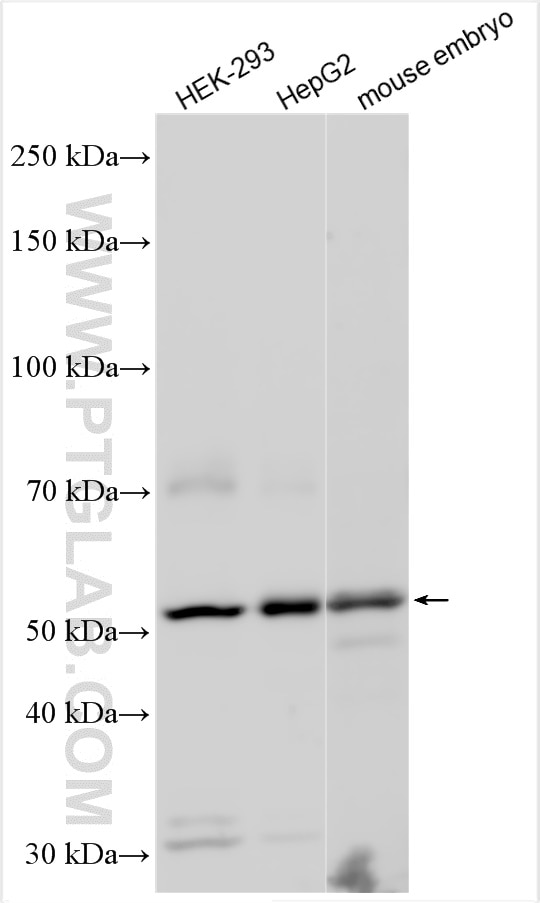 Western Blot (WB) analysis of various lysates using FOXN3 Polyclonal antibody (25399-1-AP)