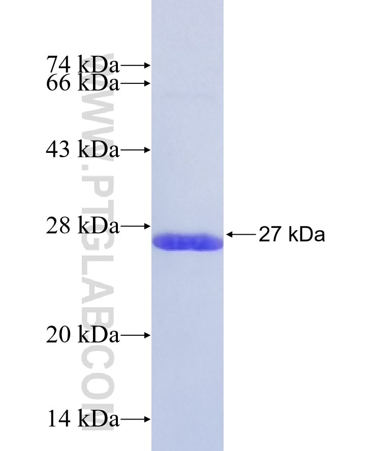 FOXN4 fusion protein Ag37329 SDS-PAGE