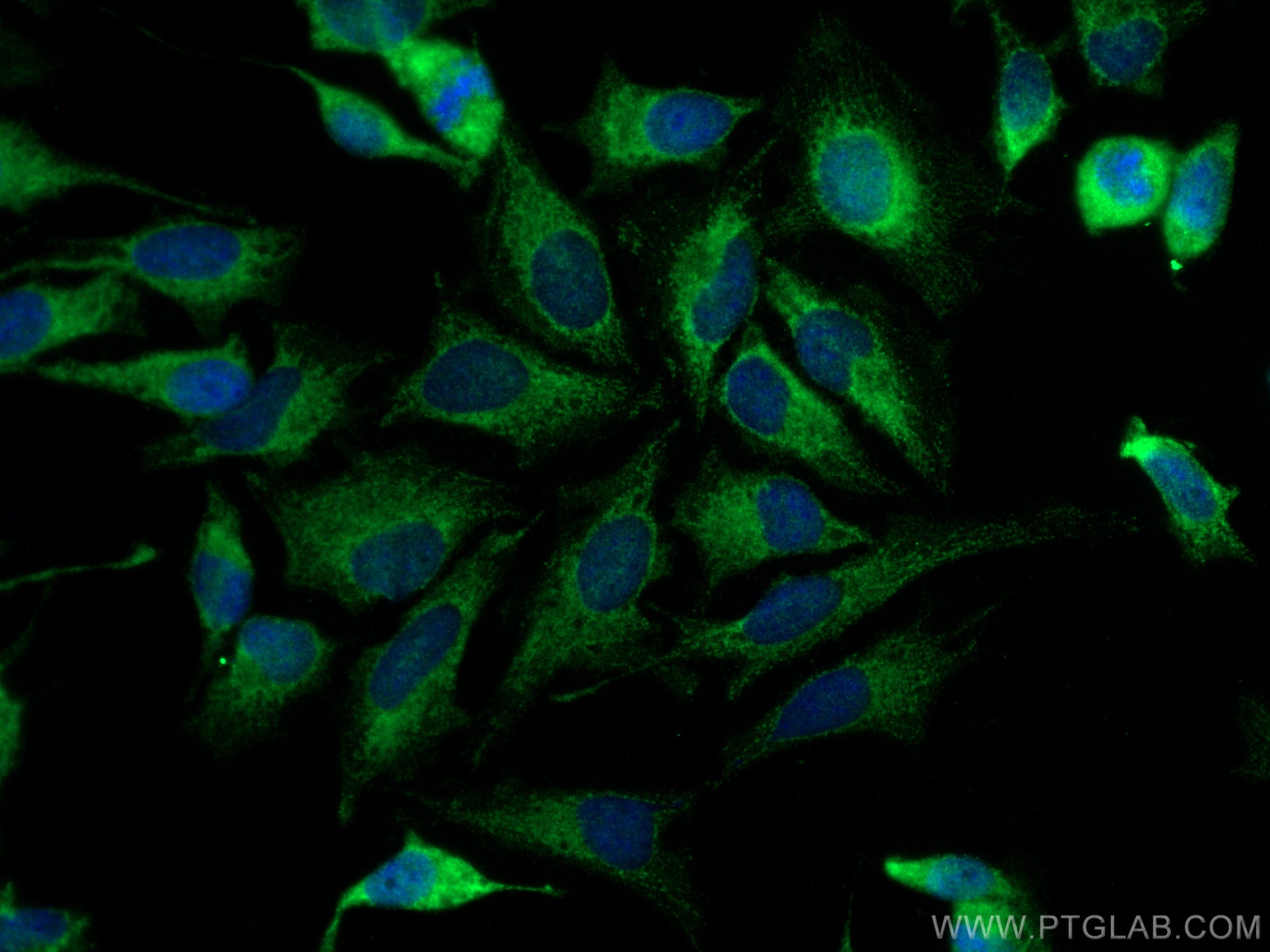 Immunofluorescence (IF) / fluorescent staining of HeLa cells using FOXO1 Polyclonal antibody (18592-1-AP)