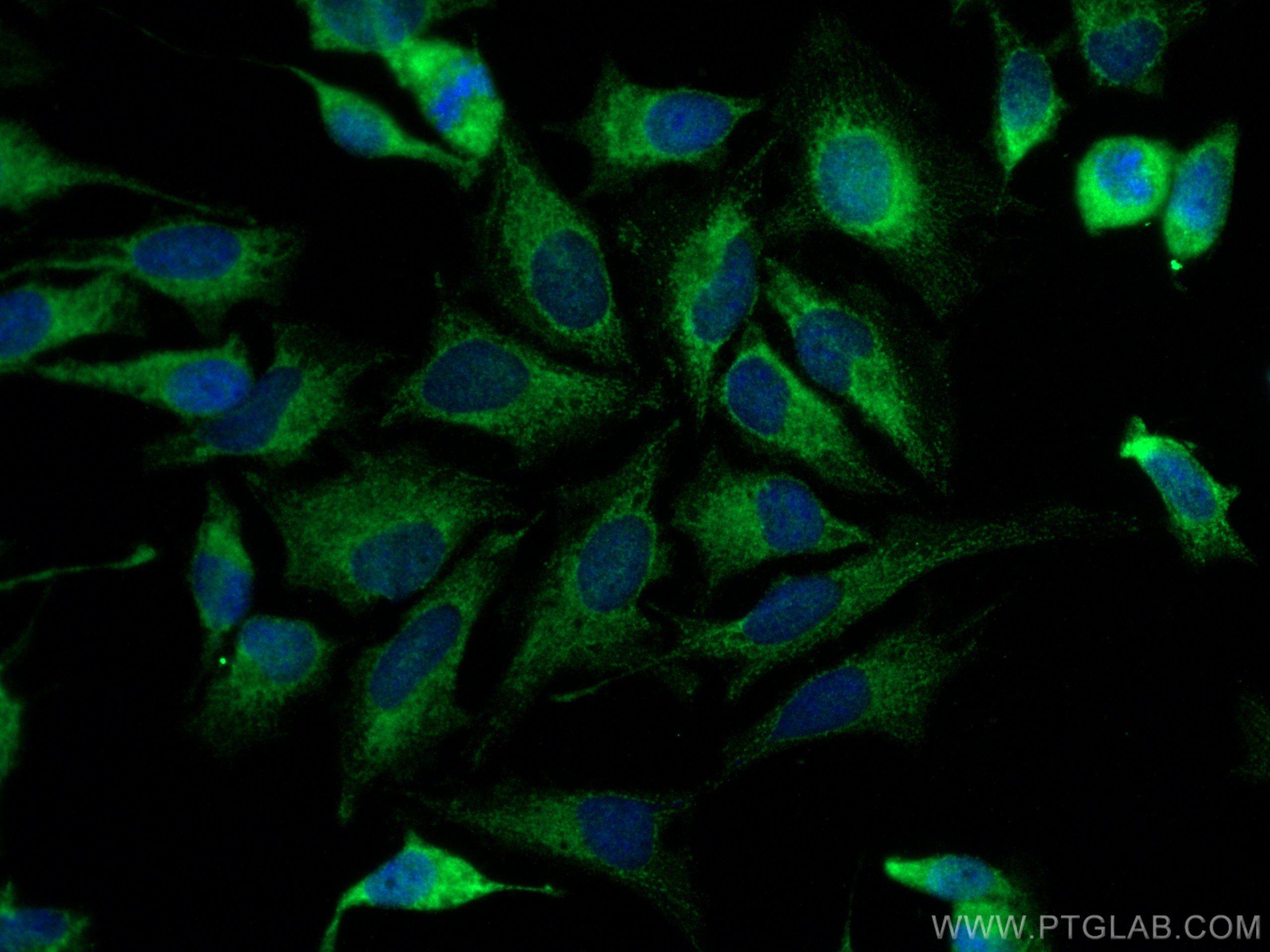 IF Staining of HeLa using 18592-1-AP