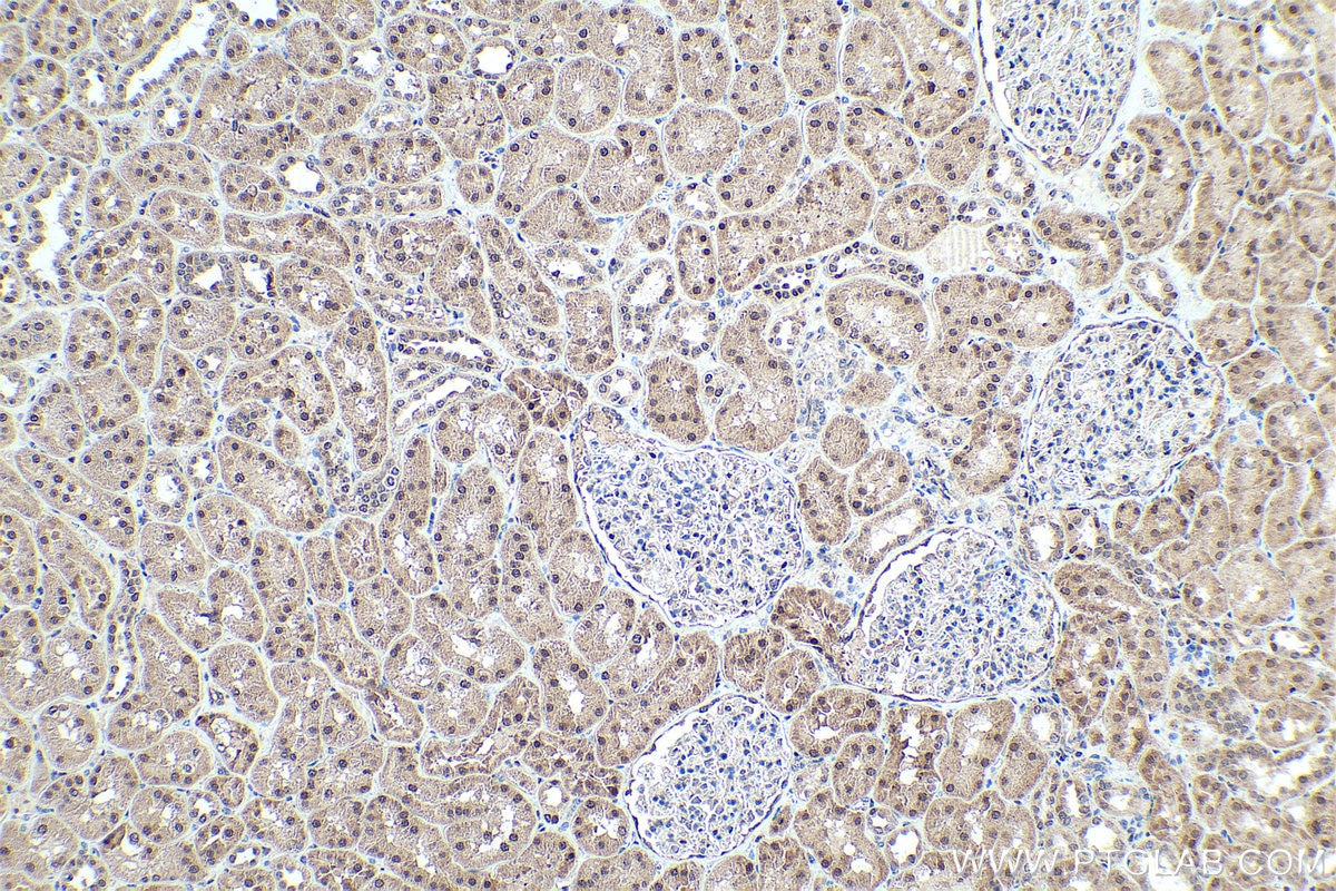 Immunohistochemistry (IHC) staining of human kidney tissue using FOXO1 Polyclonal antibody (18592-1-AP)