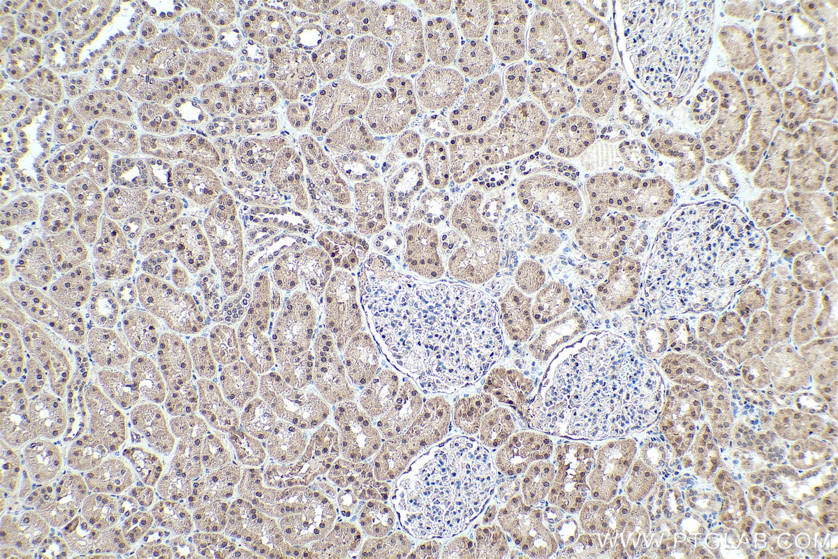 IHC staining of human kidney using 18592-1-AP