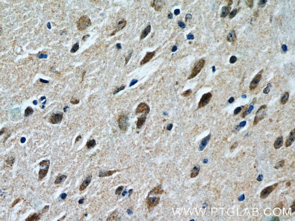 FOXO1 Polyclonal antibody