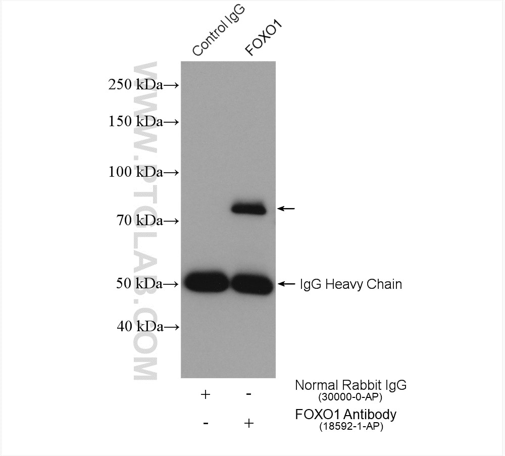 Immunoprecipitation (IP) experiment of HepG2 cells using FOXO1 Polyclonal antibody (18592-1-AP)