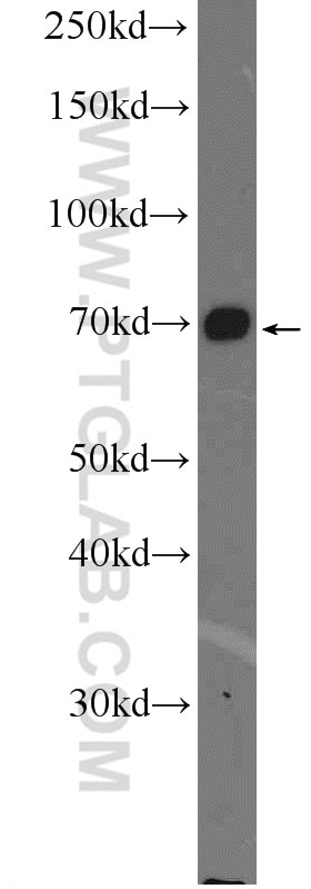 FOXO1 Polyclonal antibody