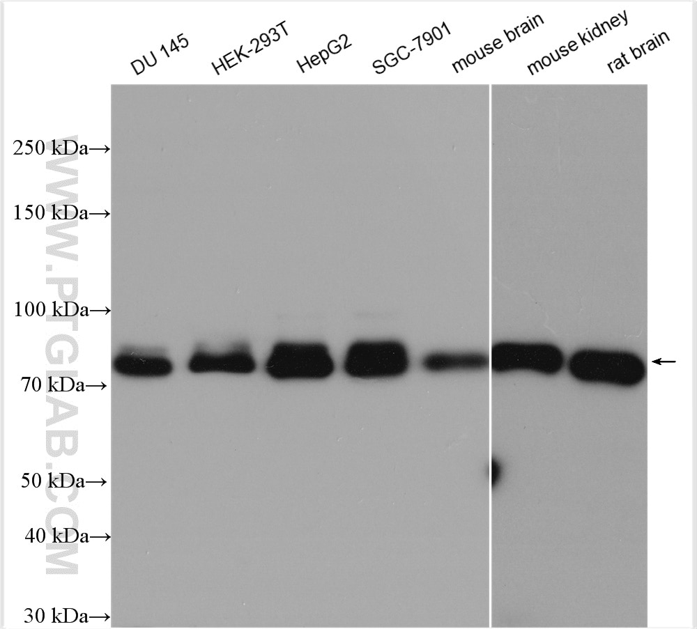 Western Blot (WB) analysis of various lysates using FOXO1 Polyclonal antibody (18592-1-AP)