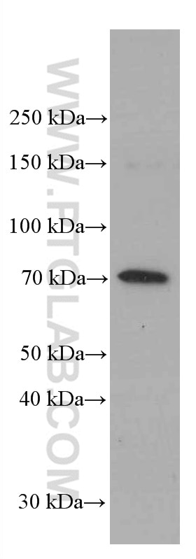 Western Blot (WB) analysis of HeLa cells using FOXO1 Monoclonal antibody (66457-1-Ig)