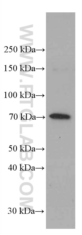 WB analysis of HeLa using 66457-1-Ig