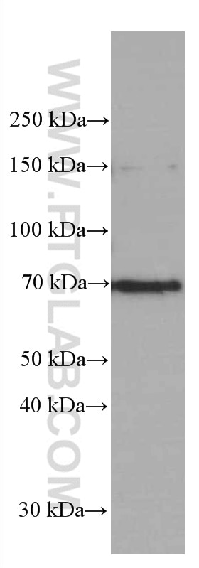 Western Blot (WB) analysis of SMMC-7721 cells using FOXO1 Monoclonal antibody (66457-1-Ig)
