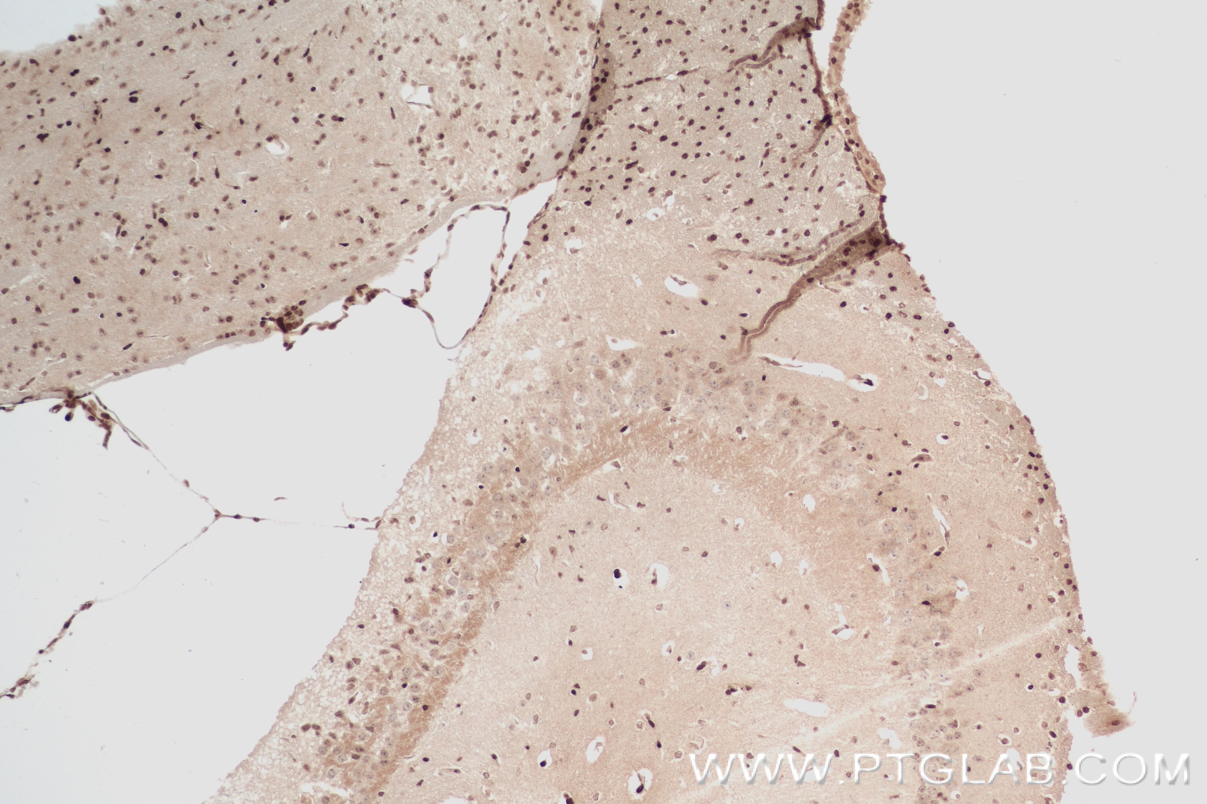 Immunohistochemical analysis of paraffin-embedded mouse brain tissue slide using 82997-1-RR (FOXO1 antibody) at dilution of 1:200 (under 10x lens). Heat mediated antigen retrieval with Tris-EDTA buffer (pH 9.0). Immunohistochemistry (IHC) staining of mouse brain tissue using FOXO1 Recombinant monoclonal antibody (82997-1-RR)