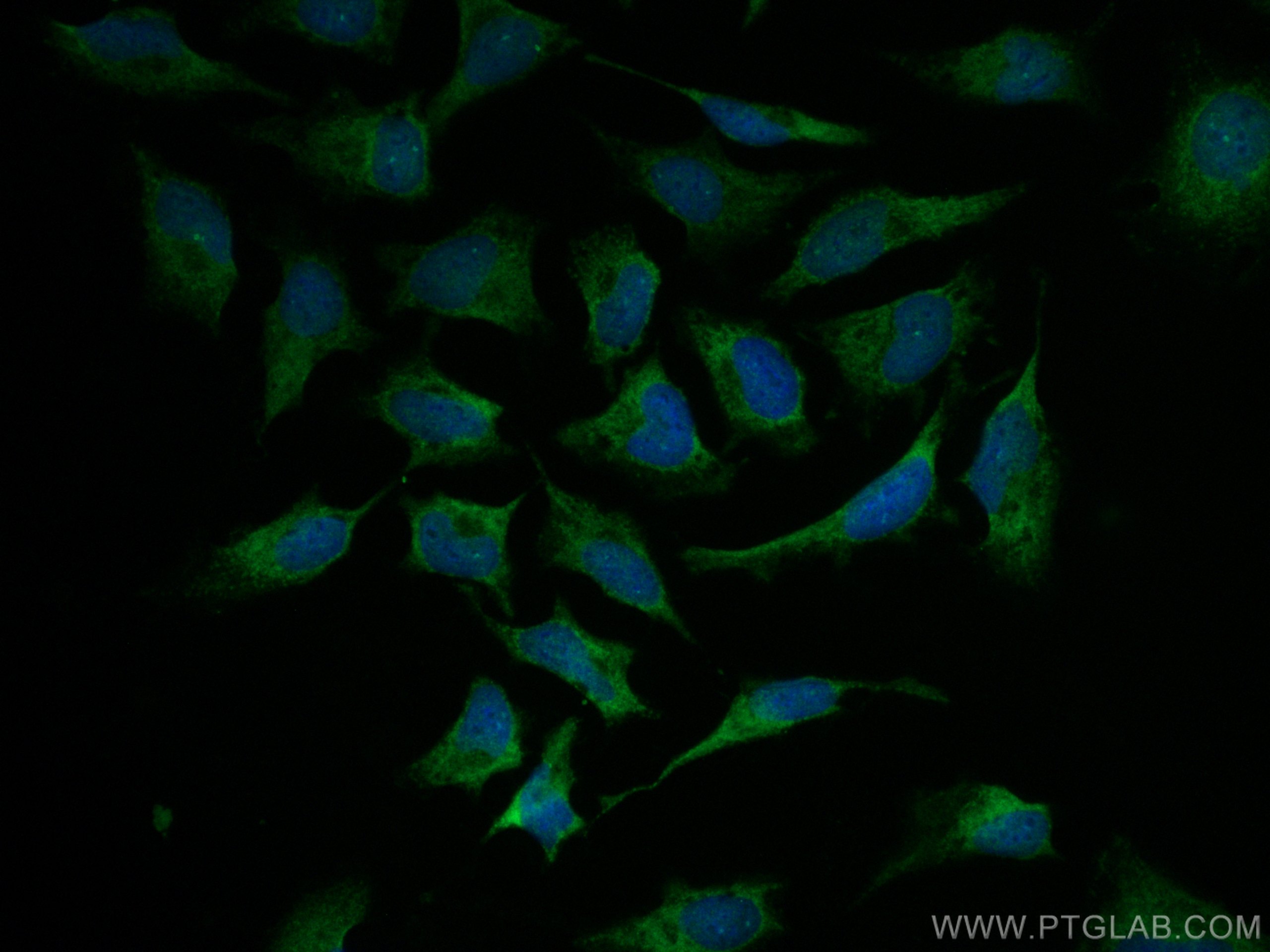 Immunofluorescence (IF) / fluorescent staining of HeLa cells using CoraLite® Plus 488-conjugated FOXO1 Polyclonal ant (CL488-18592)