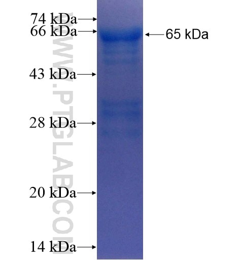 FOXO1 fusion protein Ag13296 SDS-PAGE