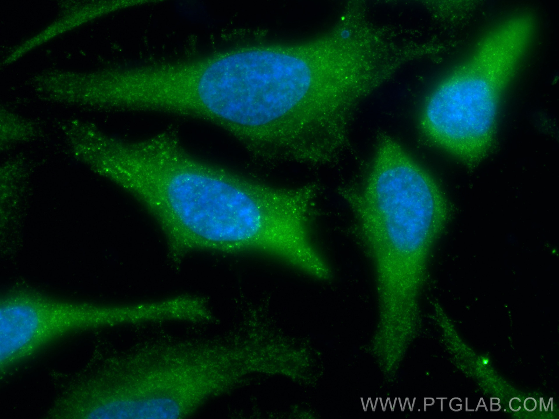 Immunofluorescence (IF) / fluorescent staining of HeLa cells using FOXO3A Polyclonal antibody (10849-1-AP)