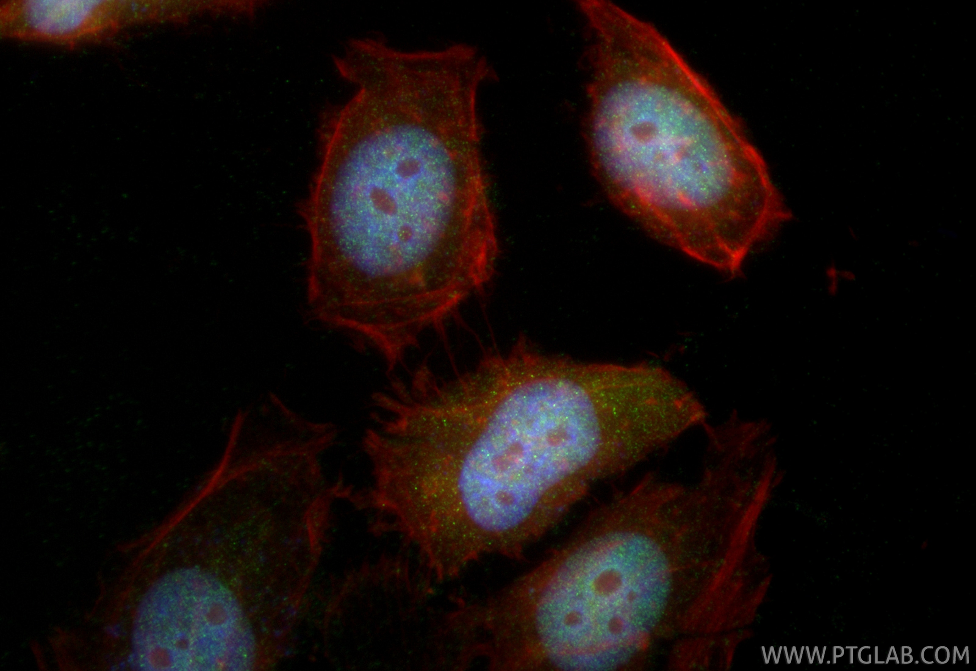 Immunofluorescence (IF) / fluorescent staining of HeLa cells using FOXO3A Polyclonal antibody (10849-1-AP)