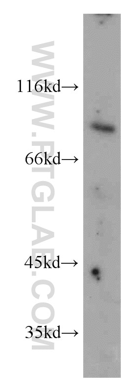 Western Blot (WB) analysis of HeLa cells using FOXO3A Polyclonal antibody (10849-1-AP)