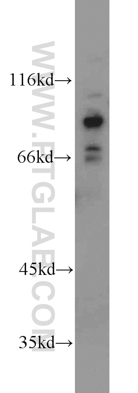 FOXO3A Polyclonal antibody