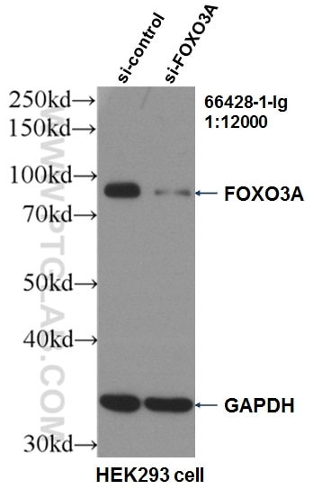Western Blot (WB) analysis of HEK-293 cells using FOXO3A Monoclonal antibody (66428-1-Ig)
