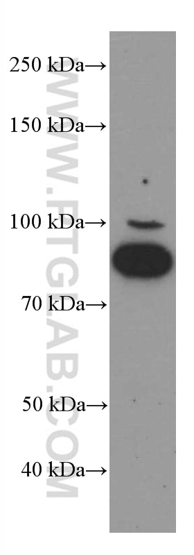 Western Blot (WB) analysis of MCF-7 cells using FOXO3A Monoclonal antibody (66428-1-Ig)