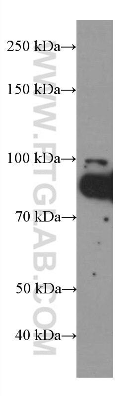Western Blot (WB) analysis of Jurkat cells using FOXO3A Monoclonal antibody (66428-1-Ig)