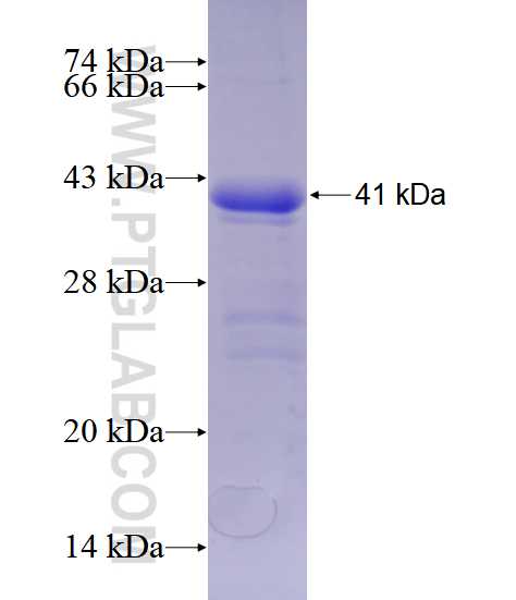 FOXO3A fusion protein Ag19543 SDS-PAGE